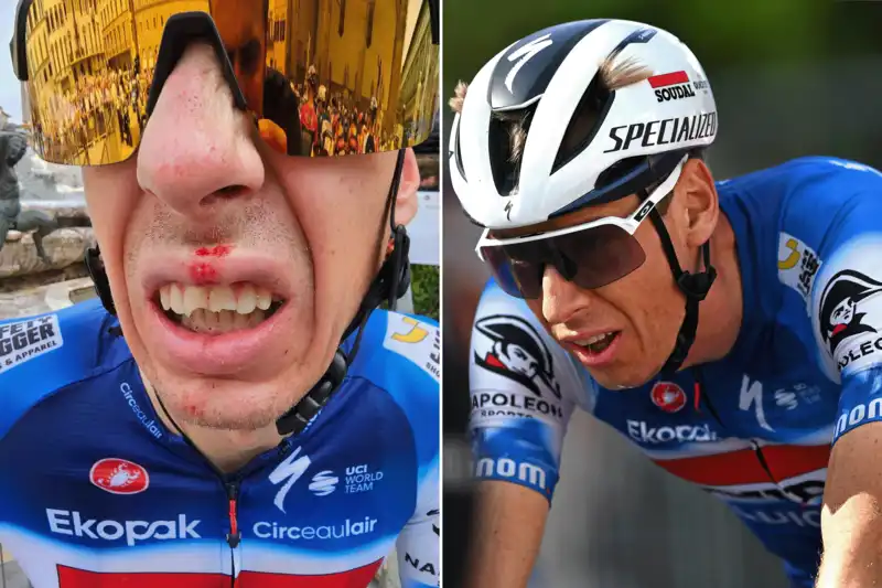 Jan Hilt breaks a tooth after being knocked over by a spectator's bag before the start of the Tour de France.